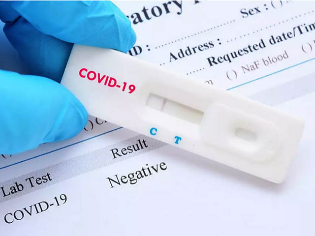 Rappel Test Pcr Pour Tous Ceux Qui Veulent Entrer En France Air Journal Rappel Test Pcr Pour Tous Ceux Qui Veulent Entrer En France Air Journal